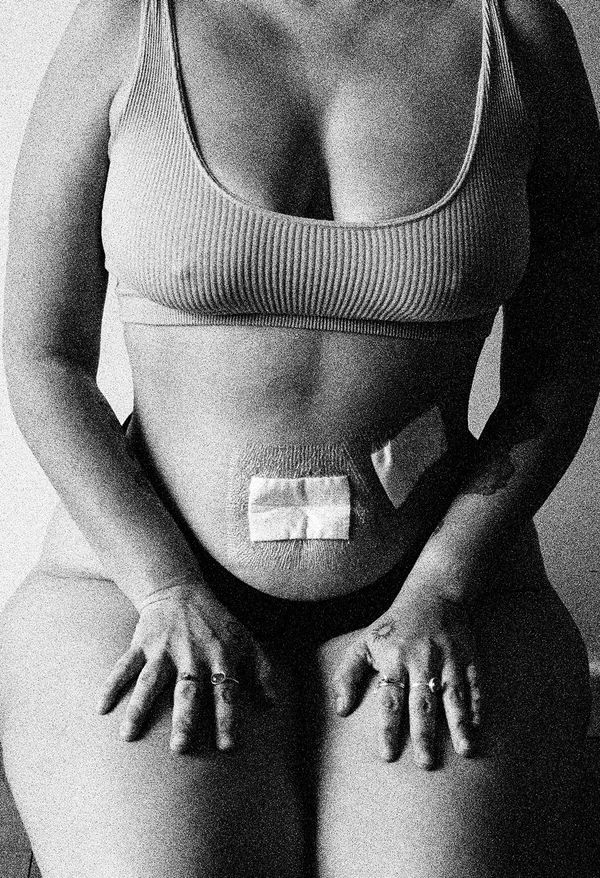 © Maria Guzman - Image from the In This Body photography project
