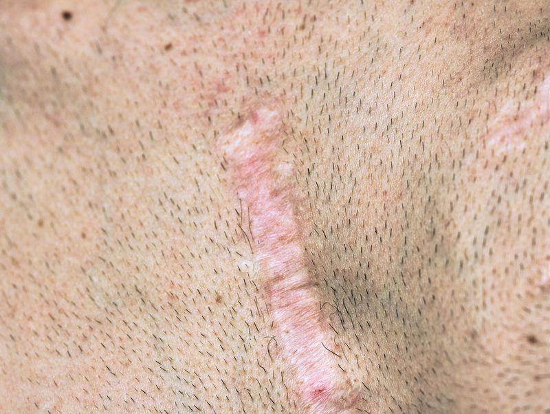 © Ivonne Thein - Image from the disobedient bodies photography project