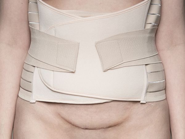 © Ivonne Thein - Image from the disobedient bodies photography project