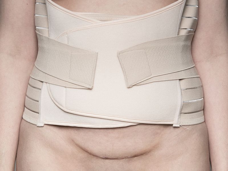 © Ivonne Thein - Image from the disobedient bodies photography project