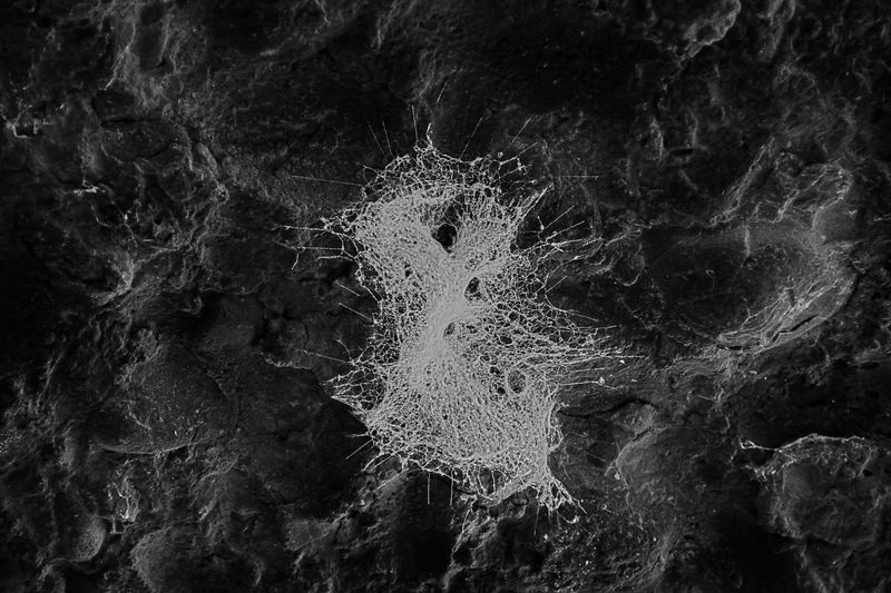 © Pelly Mandreka - Temper sterilizer brain implant - Infrared photomicrography