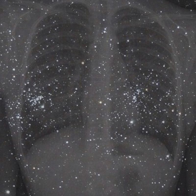 © caterina suzzi - "Non riesco più a respirare""I can't breath"