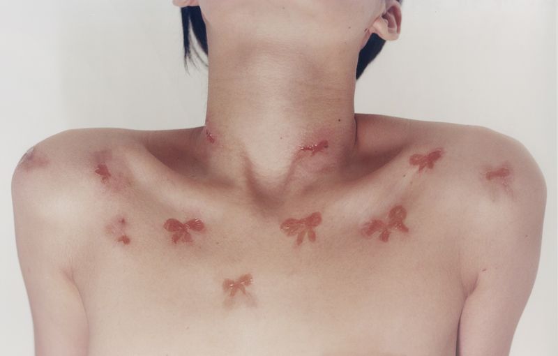 © Lean Lui - Ribbon Wound