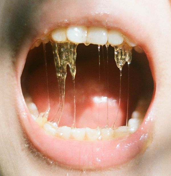 © Lean Lui - Honeytrap