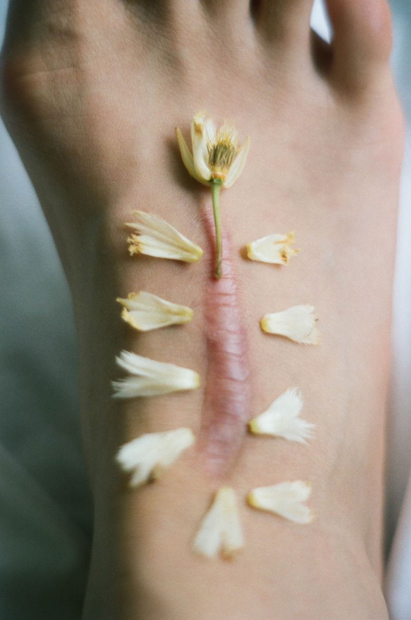© Lean Lui - Blossom Scar