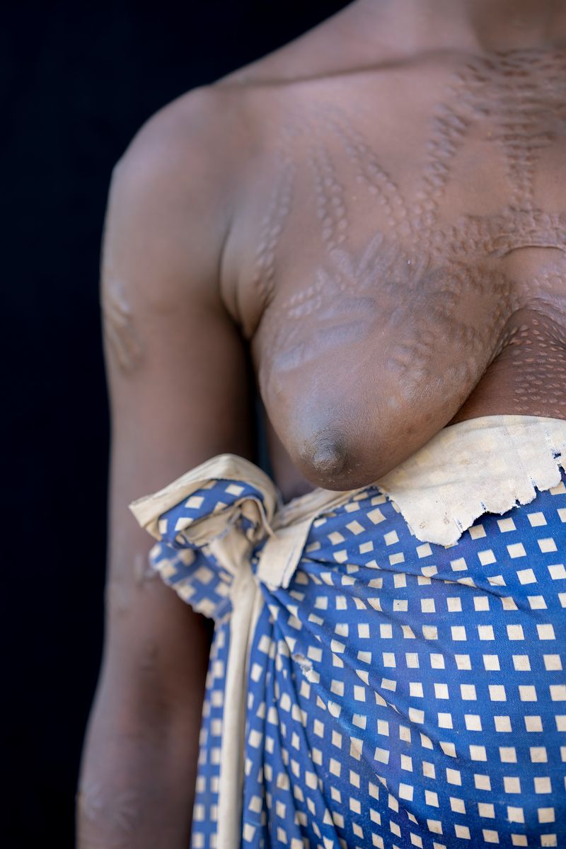 © Maricruz Sainz de Aja - Image from the "Resilience Unseen" photography project