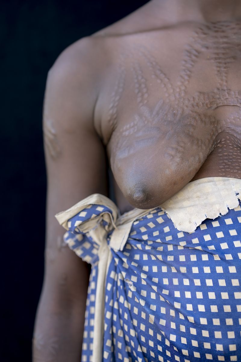 © Maricruz Sainz de Aja - Image from the "Resilience Unseen" photography project