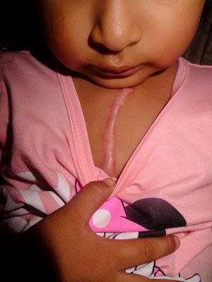 A little story about the Prados: Dialogue about Thanatos