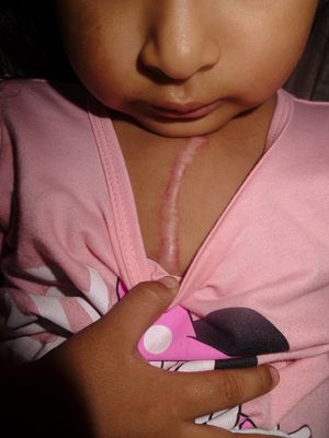 A little story about the Prados: Dialogue about Thanatos