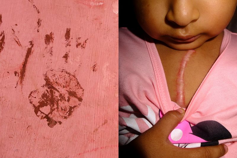 © Joel Luna Prado - Image from the El Tetas photography project