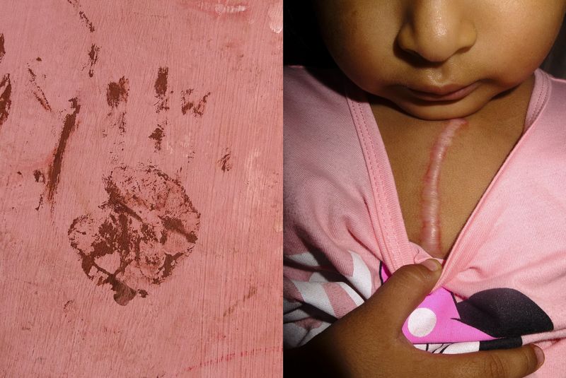 © Joel Luna Prado - Image from the El Tetas photography project