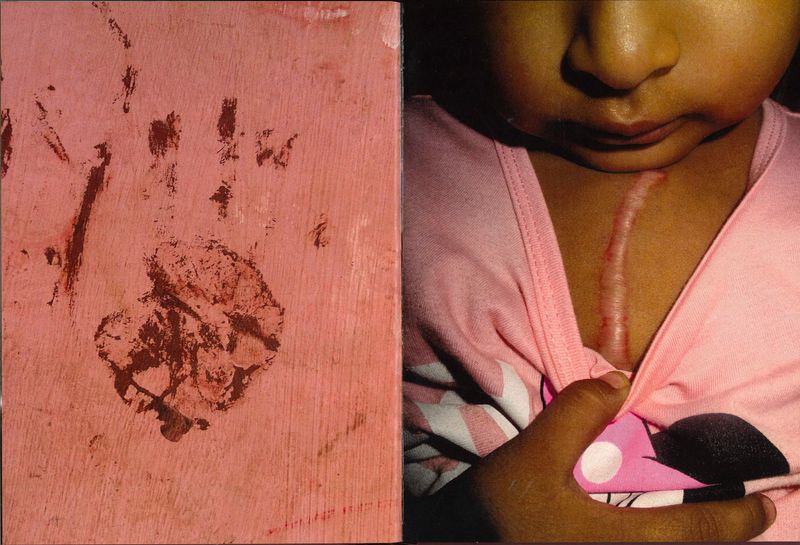 © Joel Luna Prado - Image from the El Tetas photography project