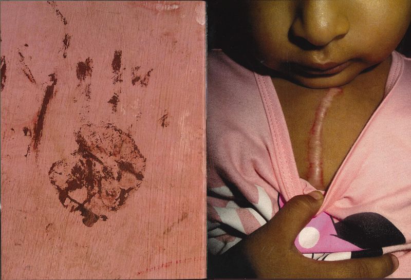 © Joel Luna Prado - Image from the El Tetas photography project