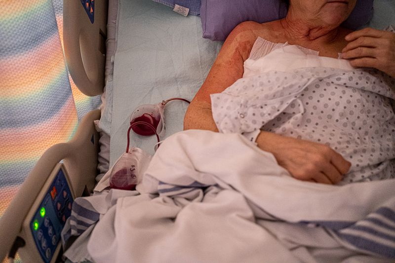 © Bobbi Barbarich - She is given four drains to eliminate the fluid from her chest-wide incision.
