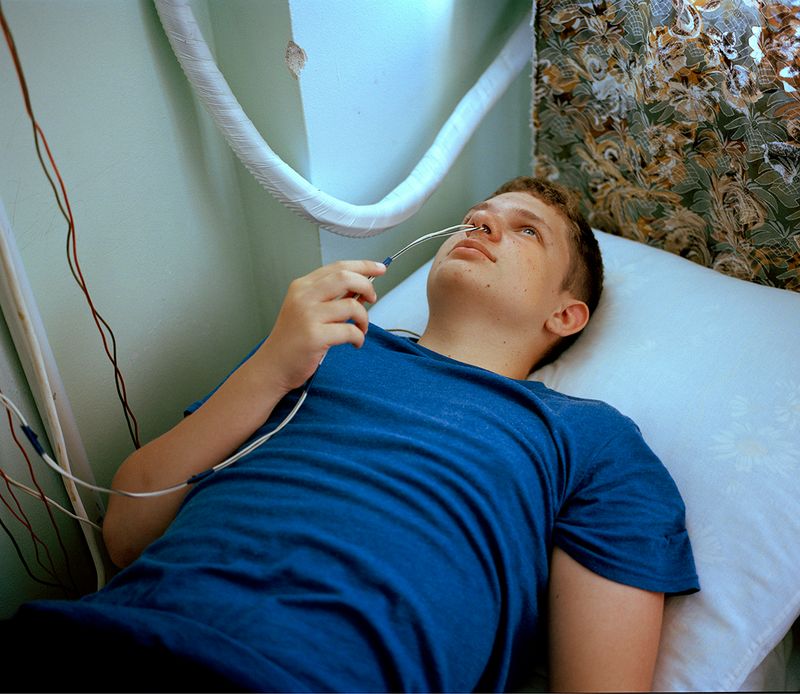 © Michal Solarski - Nose Wire. Patient getting treatment at Mishor sanatorium. August 2016, Crimea.