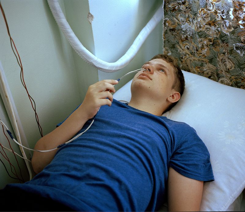 © Michal Solarski - Nose Wire. Patient getting treatment at Mishor sanatorium. August 2016, Crimea.