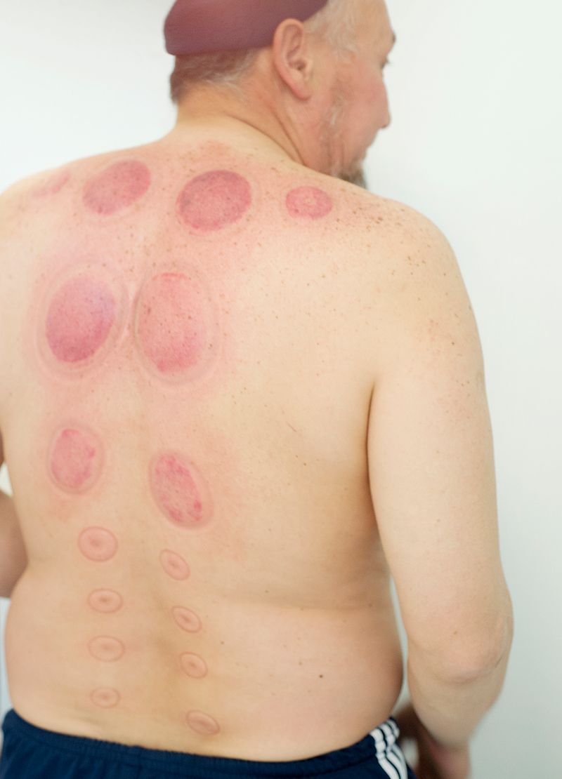 © Michal Solarski - Image from the INFIRMI photography project