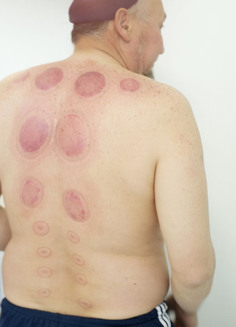 © Michal Solarski - Image from the INFIRMI photography project