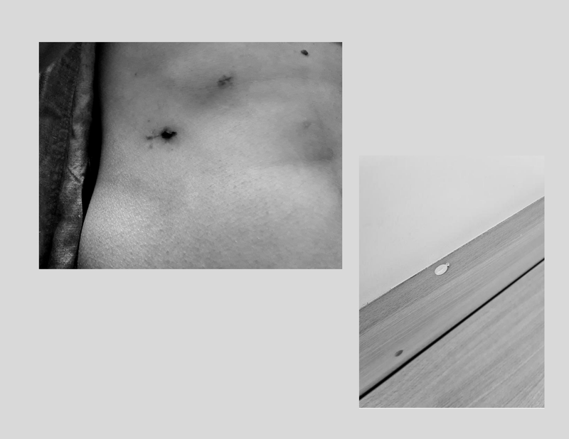 © Martyna Benedyka - Image from the Kintsugi photography project