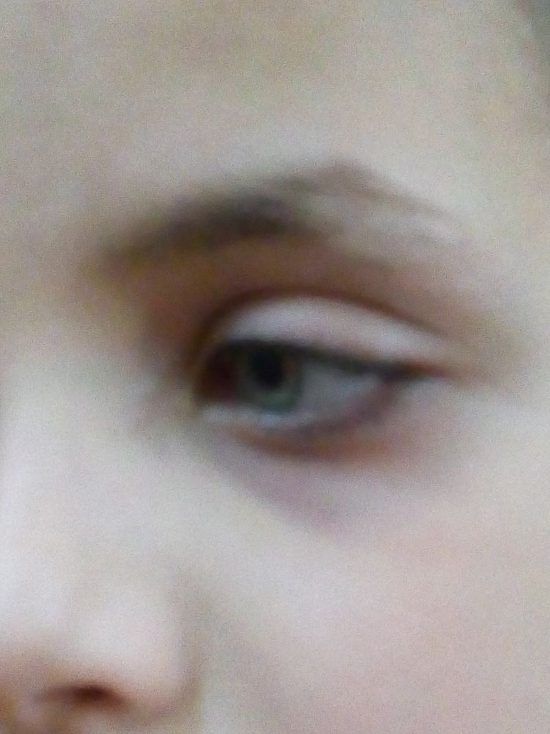 © Sana Ahmadizadeh - “Look at my eye”Cellphone taken by Fahime on request to document her son. Ahvaz, Iran.