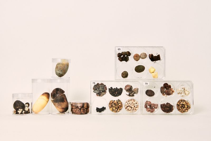 © Caroline Heinecke - © CarolineHeinecke, Masters of Things – Gallstones