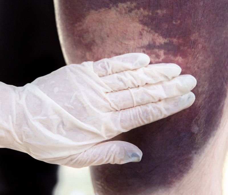 © Jędrzej Nowicki - Image from the The Scars photography project