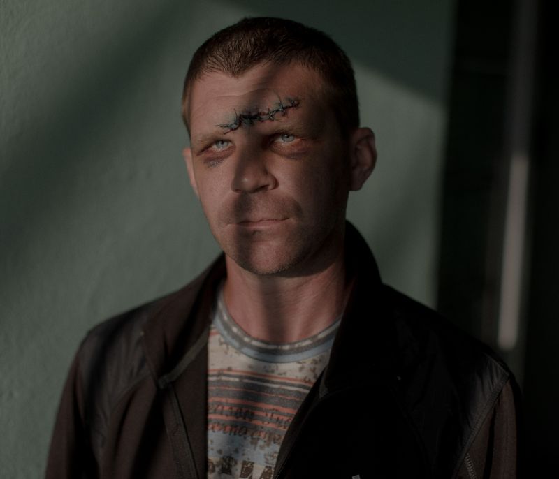 © Jędrzej Nowicki - Image from the The Scars photography project