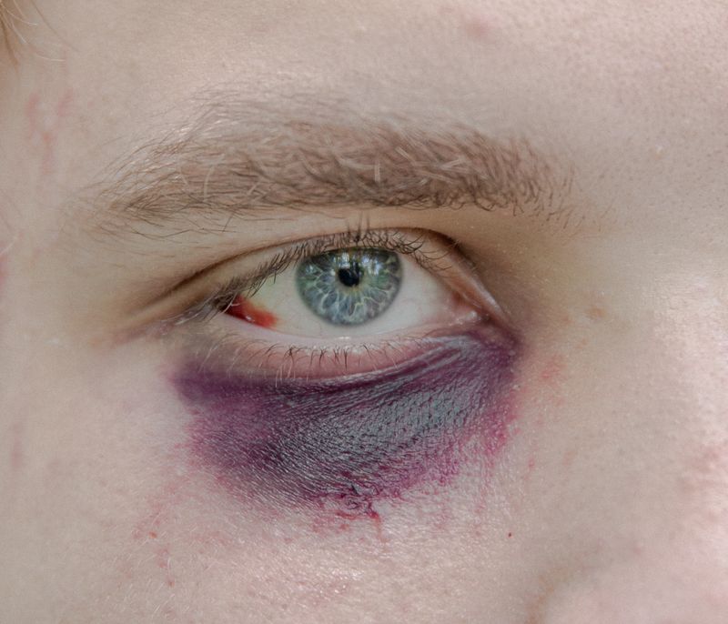 © Jędrzej Nowicki - Image from the The Scars photography project