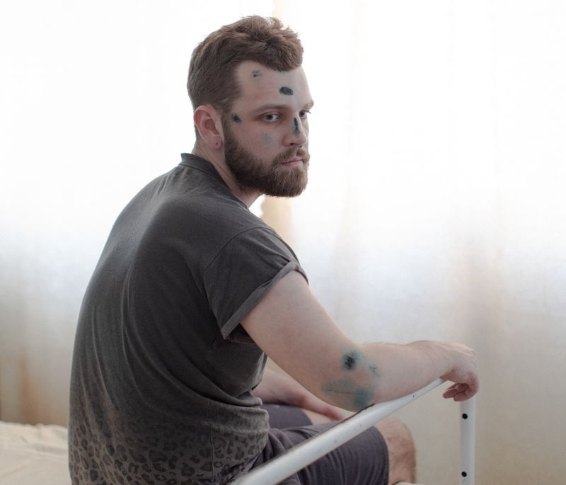 © Jędrzej Nowicki - Image from the The Scars photography project