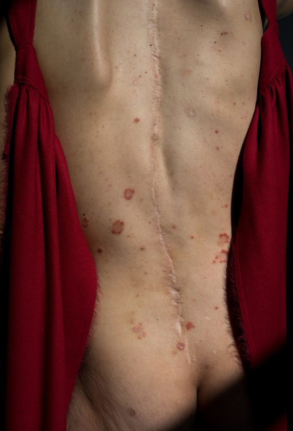 © Lilia Li-mi-yan - Image from the Turning Against the Self photography project