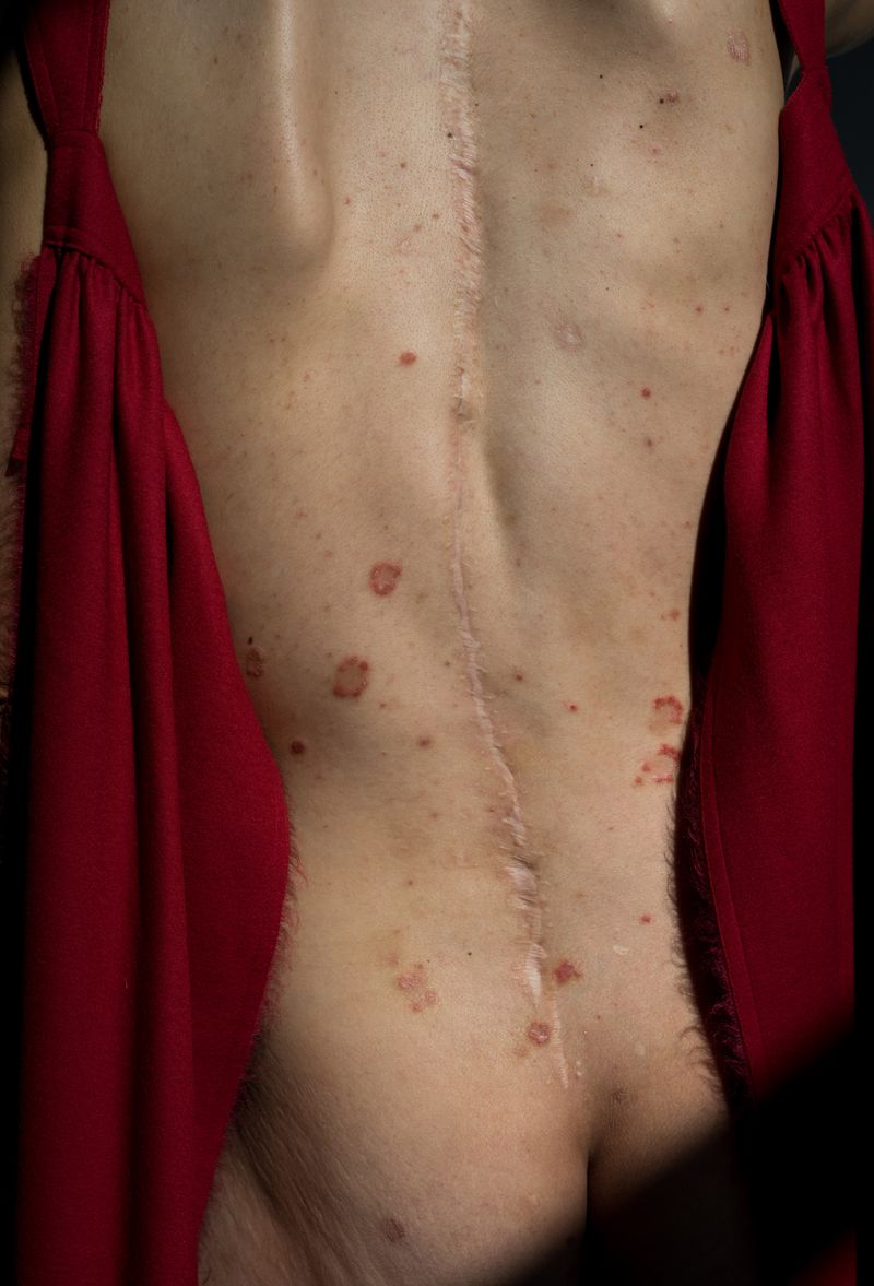 © Lilia Li-mi-yan - Image from the Turning Against the Self photography project