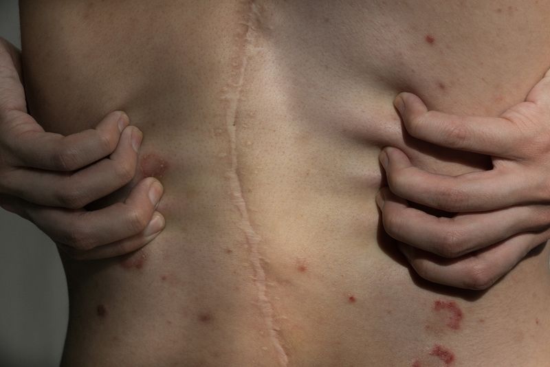 © Lilia Li-mi-yan - Image from the Turning Against the Self photography project