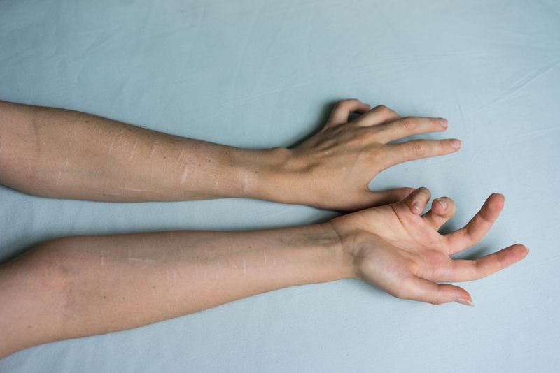 © Lilia Li-mi-yan - Image from the Turning Against the Self photography project