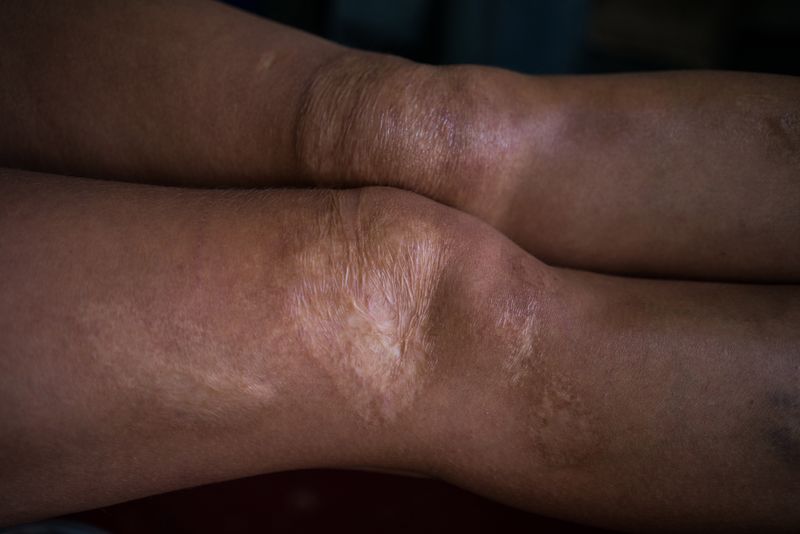 © Lilia Li-mi-yan - Image from the Turning Against the Self photography project