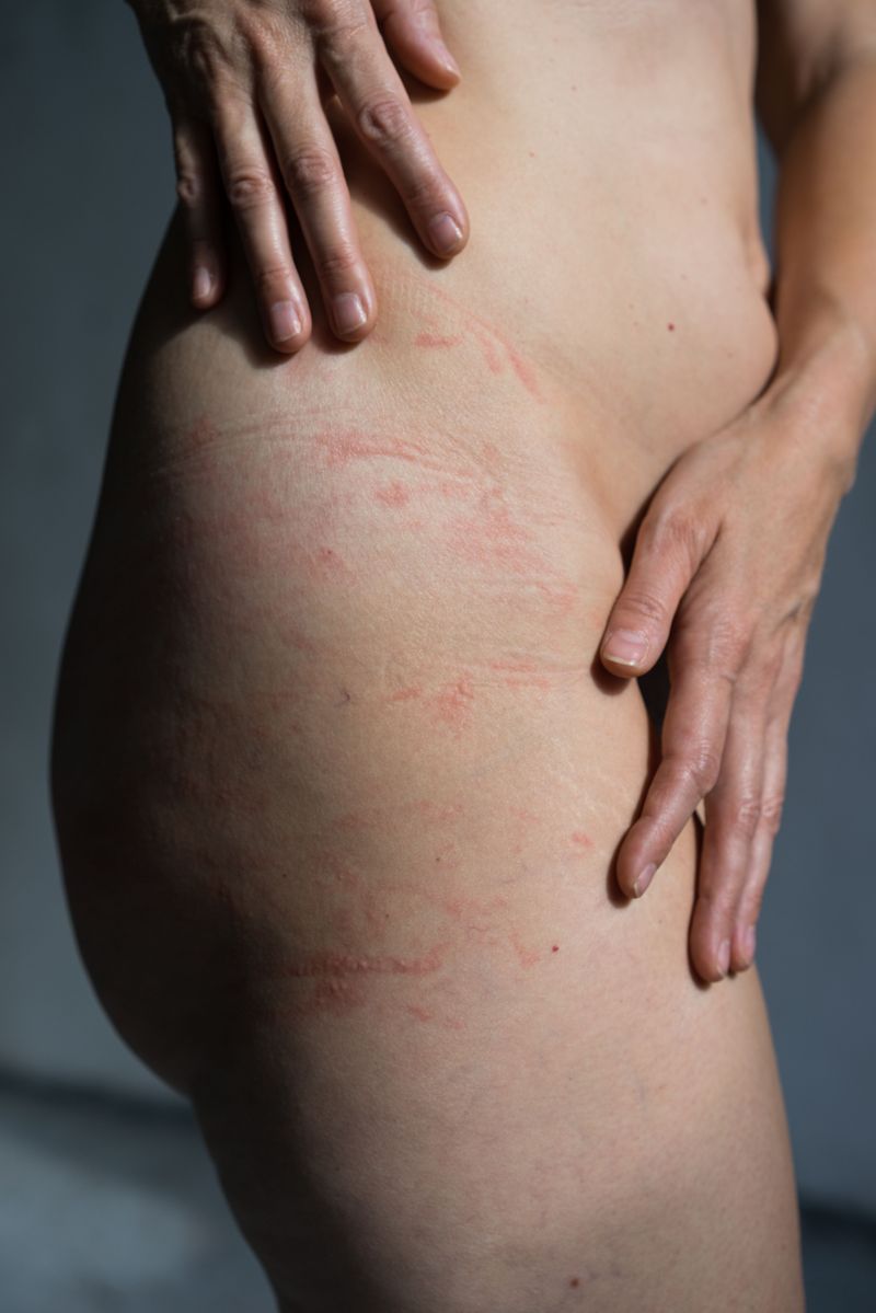 © Lilia Li-mi-yan - Image from the Turning Against the Self photography project