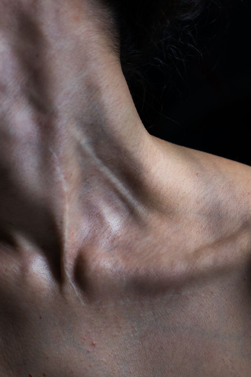 © Lilia Li-mi-yan - Image from the Turning Against the Self photography project