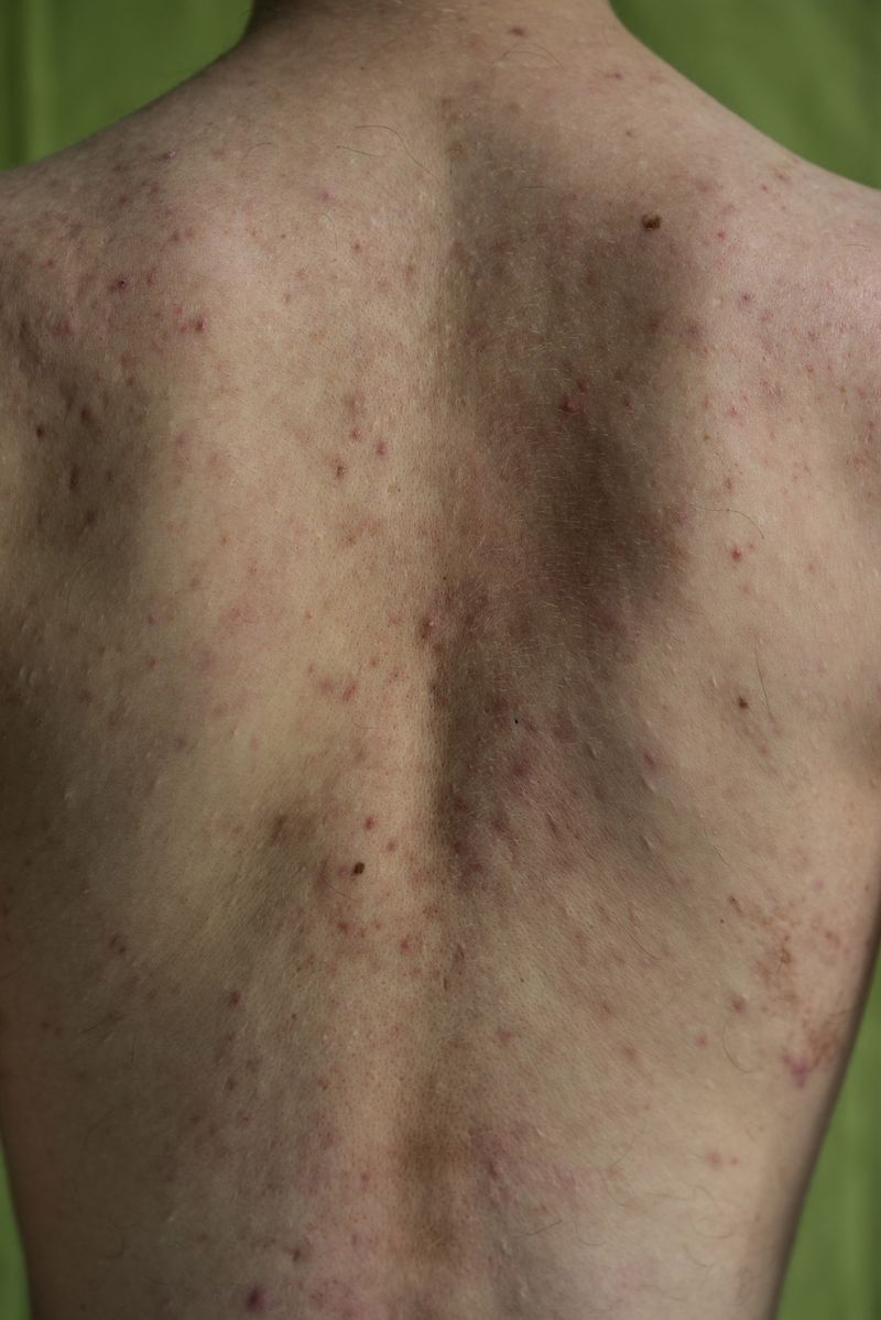 © Lilia Li-mi-yan - Image from the Turning Against the Self photography project