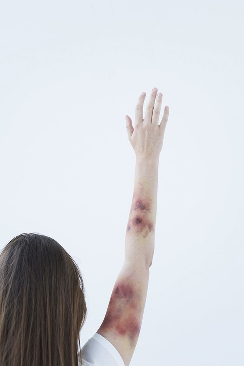 © Fanny Beckman - Image from the I Just Slipped photography project