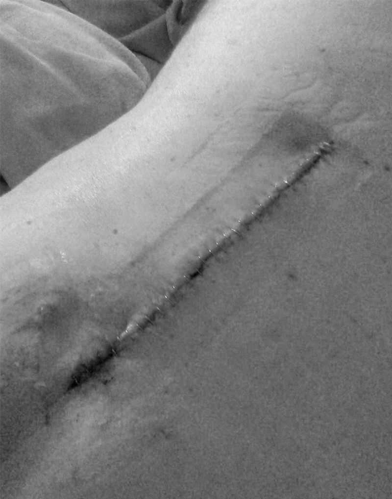 © Diane Fenster - Stygian Cut