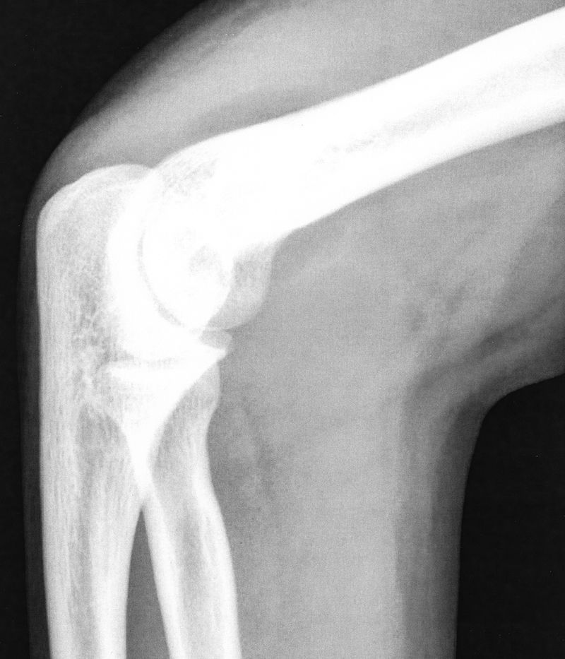 © Max Ferdinand Langer - X-ray scan