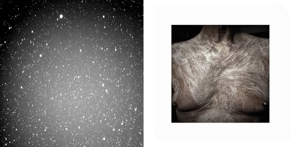 © Sara Munari - 1. The sky above my father's house 2. Preparation for the operation. Patients are totally shaved to avoid infections