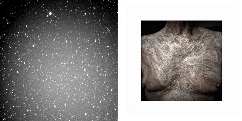 © Sara Munari - 1. The sky above my father's house 2. Preparation for the operation. Patients are totally shaved to avoid infections