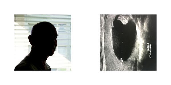 © Sara Munari - Image from the Controcanto photography project