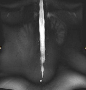 My body cries tears of beauty