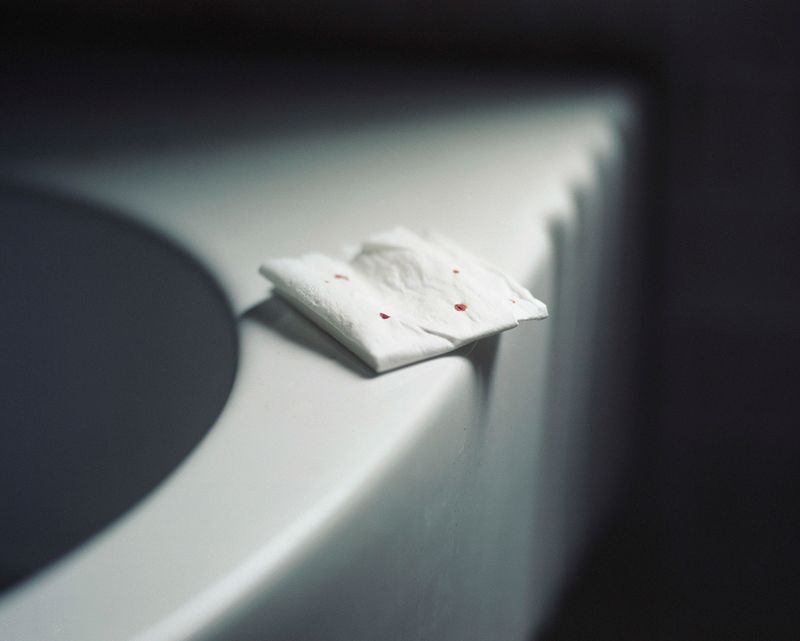 © Bowei Yang - The wounds, Hangzhou, China, 2016.