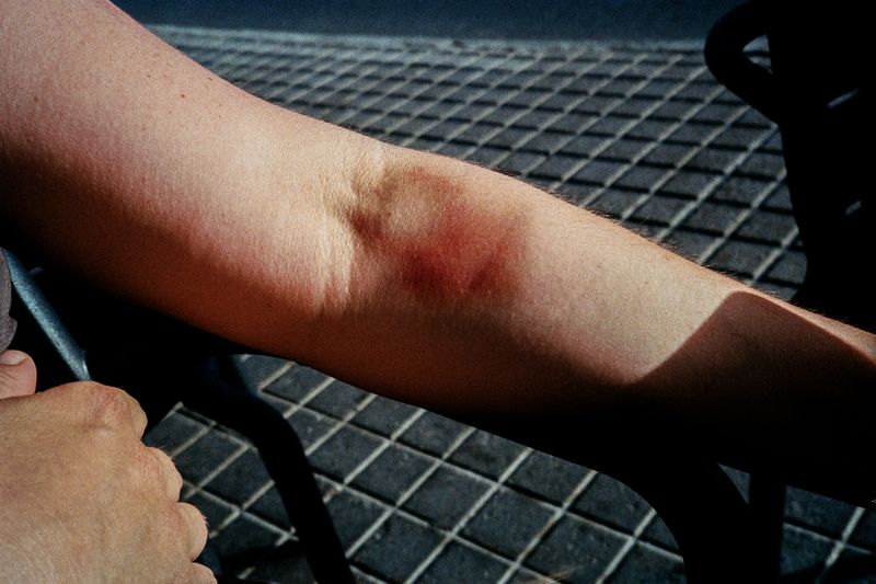 © Alex Domènech - Image from the Skin photography project