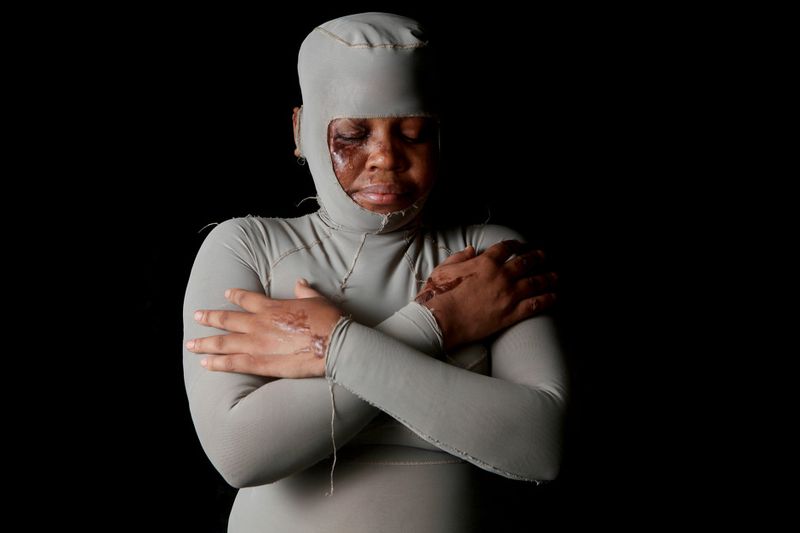 © Orlando Barria Photos - Image from the Women victims of acid photography project