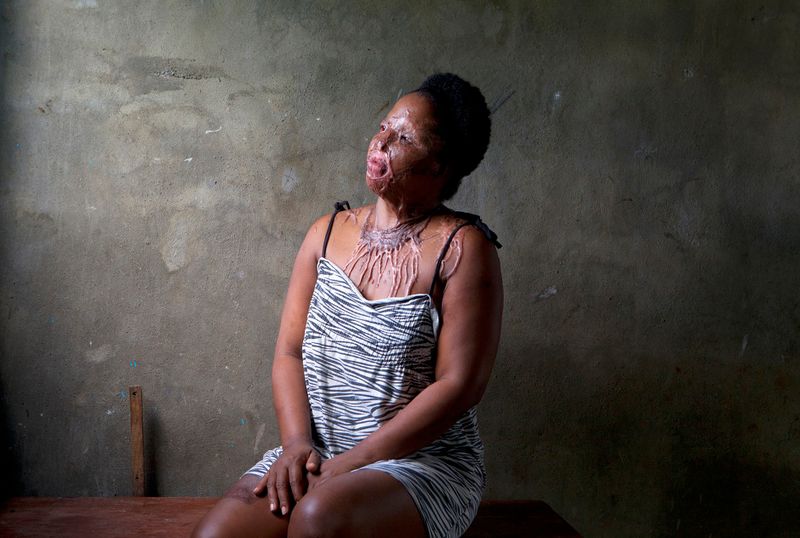 © Orlando Barria Photos - Image from the Women victims of acid photography project