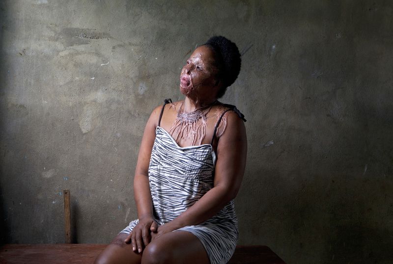 © Orlando Barria Photos - Image from the Women victims of acid photography project