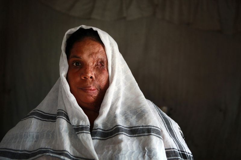 © Orlando Barria Photos - Image from the Women victims of acid photography project